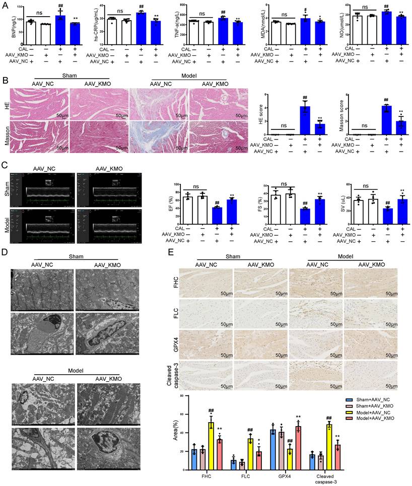 Inhibition Of KMO Ameliorates Myocardial Ischemia Injury Via