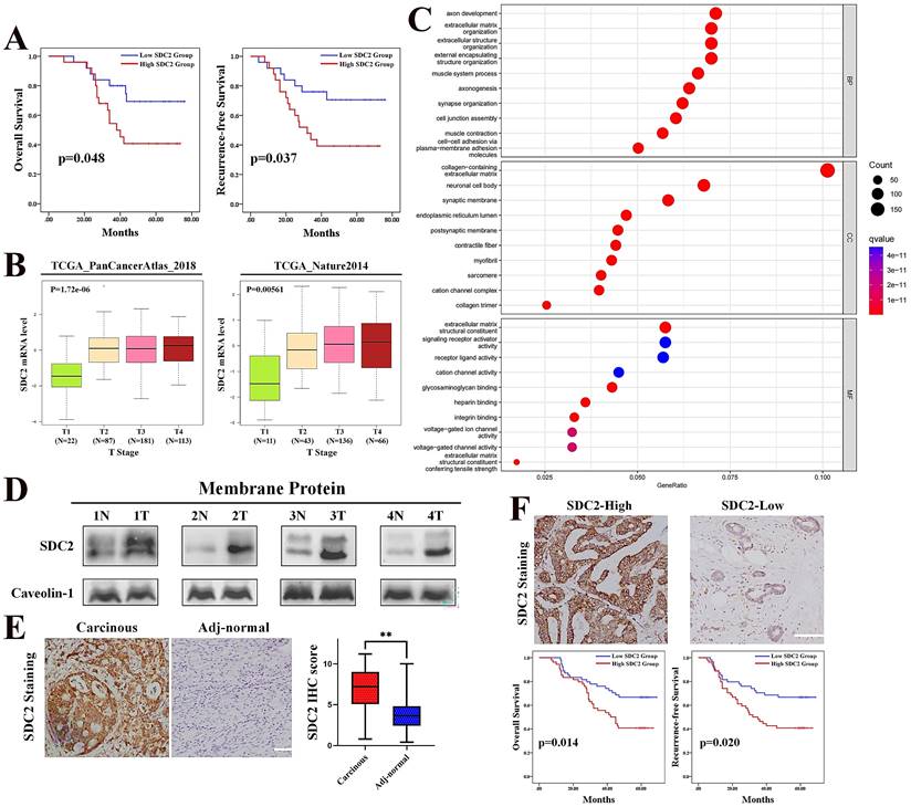 SDC2 Stabilization By USP14 Promotes Gastric Cancer Progression Through