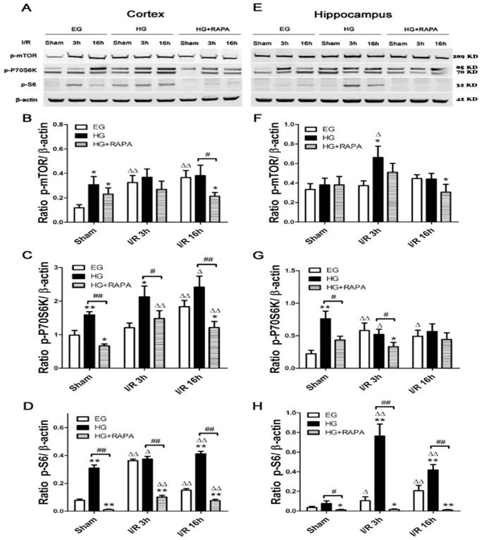 Inhibition of mTOR signaling Confers Protection against Cerebral ...