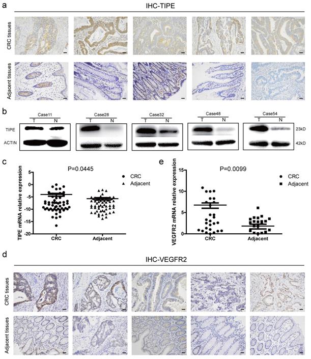 Tipe Regulates Vegfr2 Expression And Promotes Angiogenesis In Colorectal Cancer