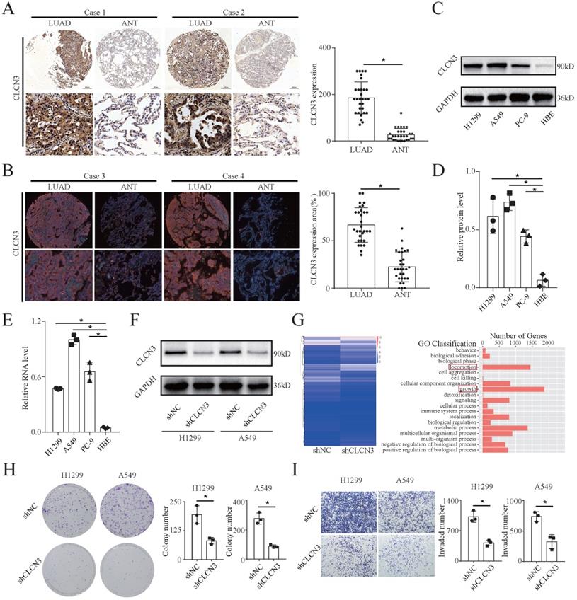 HNRNPK/CLCN3 axis facilitates the progression of LUAD through CAF-tumor ...