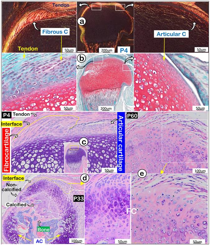 Fibrocartilage Slide Labeled