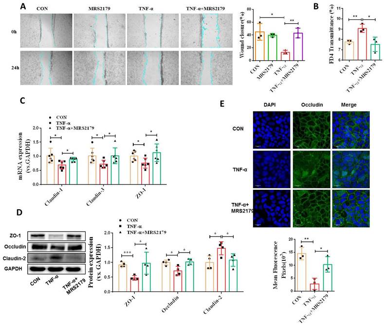 Activation of P2Y1R impedes intestinal mucosa repair during colitis