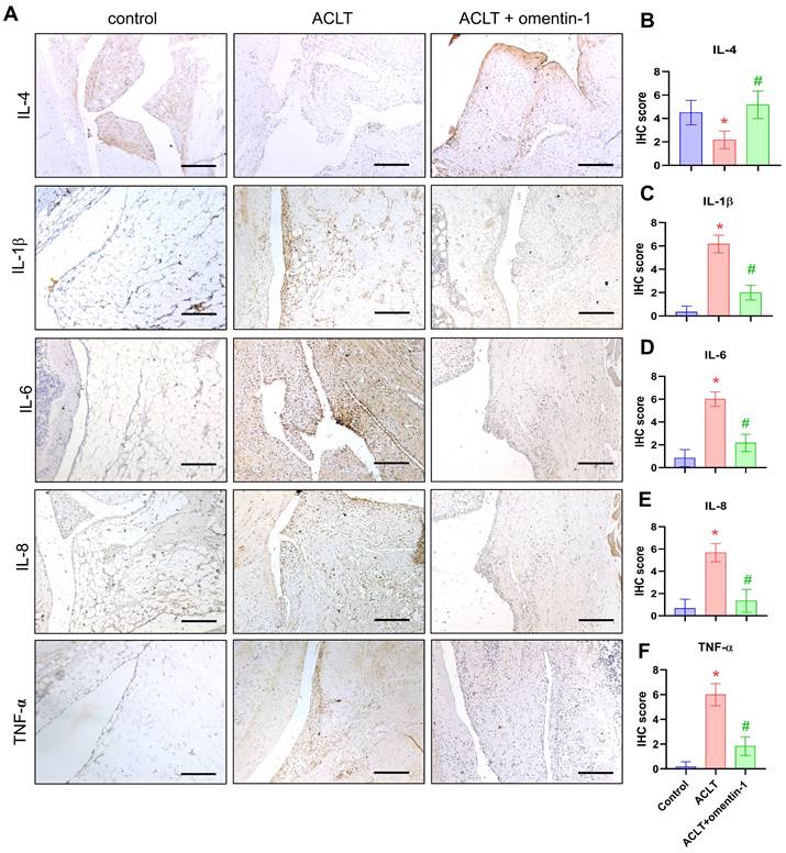 Omentin-1 ameliorates the progress of osteoarthritis by promoting IL-4 ...